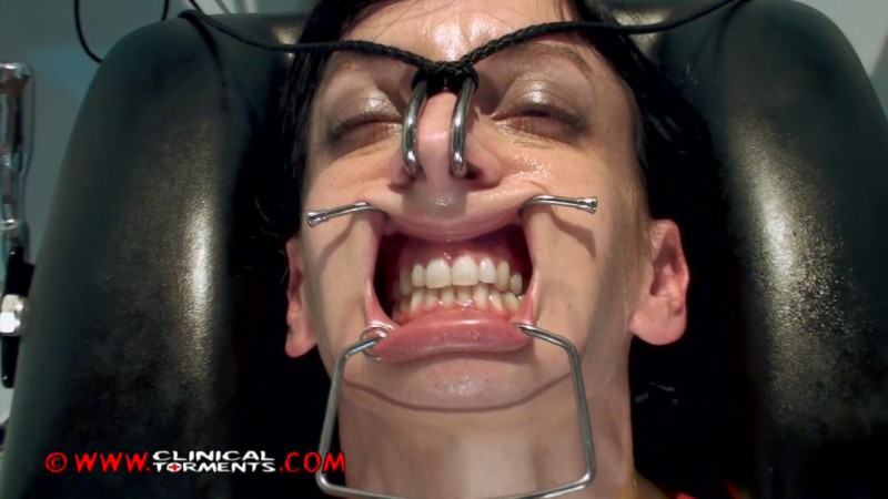 Tooth Fetish Porn - Dentist Â« Hardcore Extreme â€“ BDSM & Fetish Porn