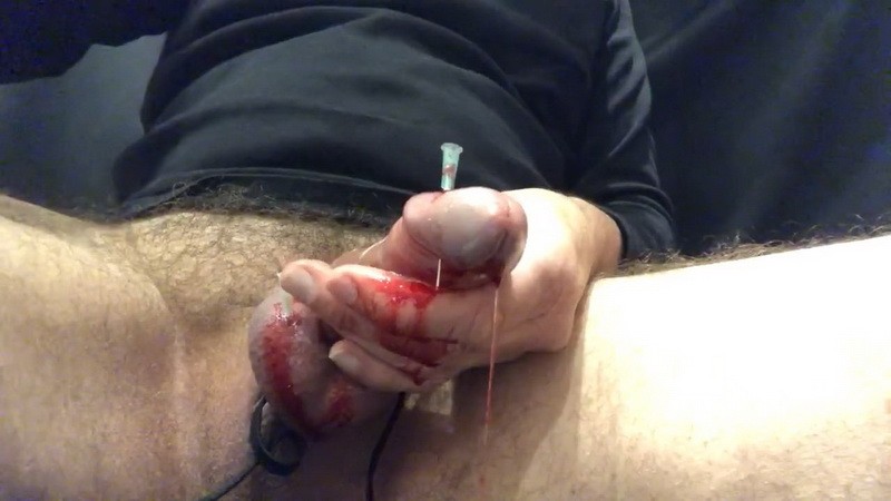 CBT Needles. (66 Mb)